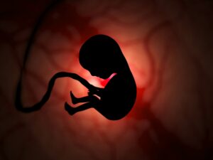 Silhouette of a human embryo on ultrasound examination in the womb during pregnancy. A baby with an
